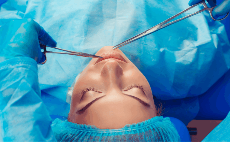 Lip lift: zabieg, który eksponuje usta i odmładza twarz bez wypełniaczy